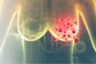 Cuál es la supersemilla que ayuda a prevenir el cáncer de mamá