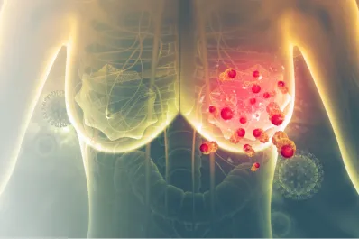 Cuál es la supersemilla que ayuda a prevenir el cáncer de mamá