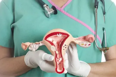 Cáncer de ovario: los cinco síntomas que se confunden con una molestia intestinal