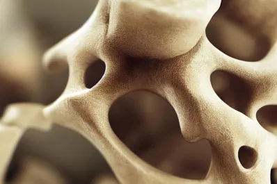 Esta es la mejor vitamina para prevenir la pérdida ósea y combatir la osteoporosis