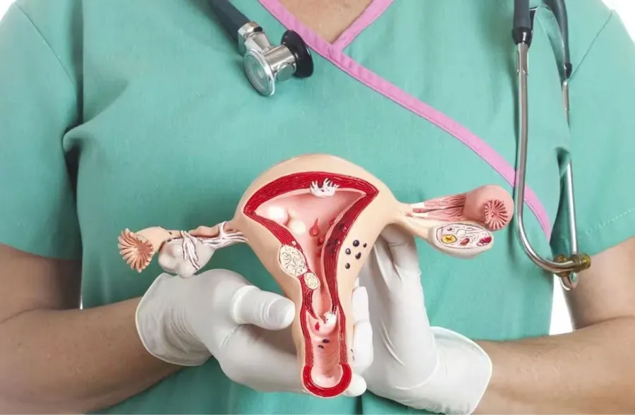 El cáncer de ovario es uno de los más difíciles de detectar