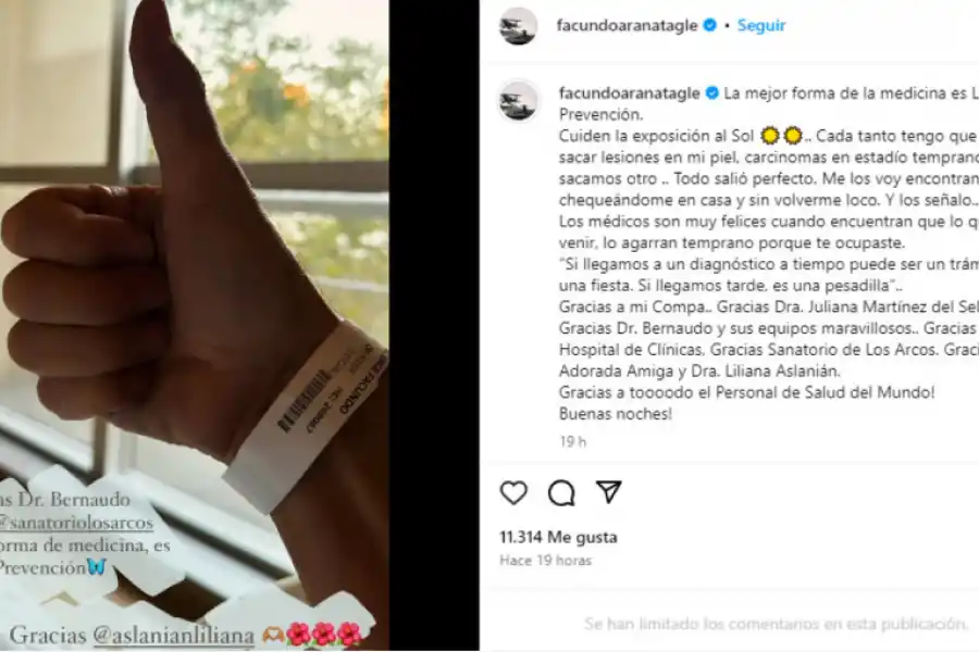 El conmovedor posteo con el que Facundo Arana confirmó que tiene cáncer de piel