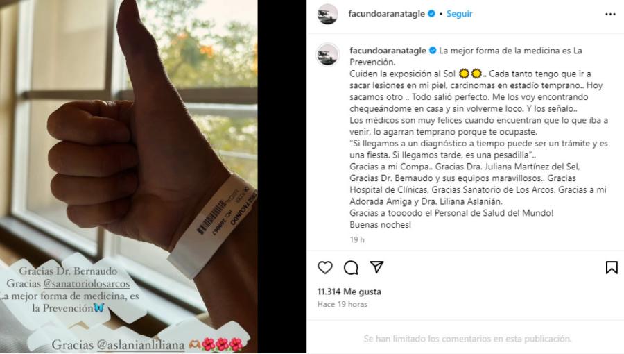 El conmovedor posteo con el que Facundo Arana confirmó que tiene cáncer de piel