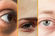 ¿Qué revelan las ojeras sobre tu salud y cuándo consultar al médico?