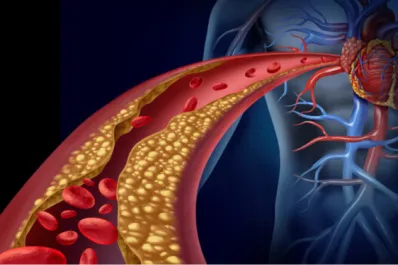 Día Mundial de la Hipertensión Arterial: cuáles son los signos de esta enfermedad que cada vez suma más adeptos