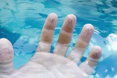 ¿Por qué nuestros dedos se arrugan al pasar mucho tiempo bajo el agua?