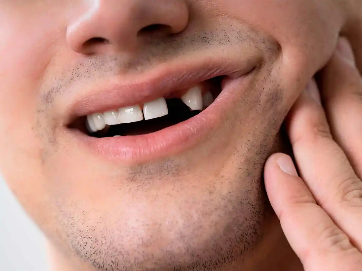 ¿Qué significa soñar que se te caen los dientes?