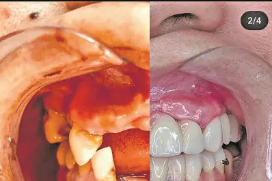 Sonreí sin límites con ROAMA Dental Clinic