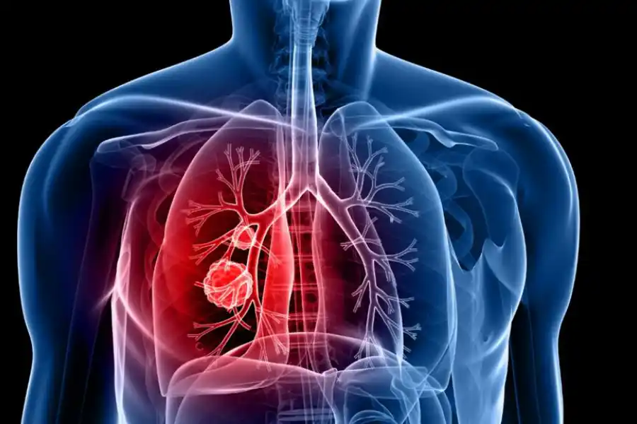 El dolor al respirar puede alertarnos un problema pulmonar.