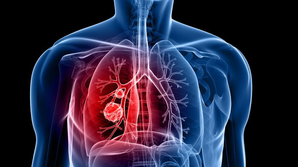 El dolor al respirar puede alertarnos un problema pulmonar.
