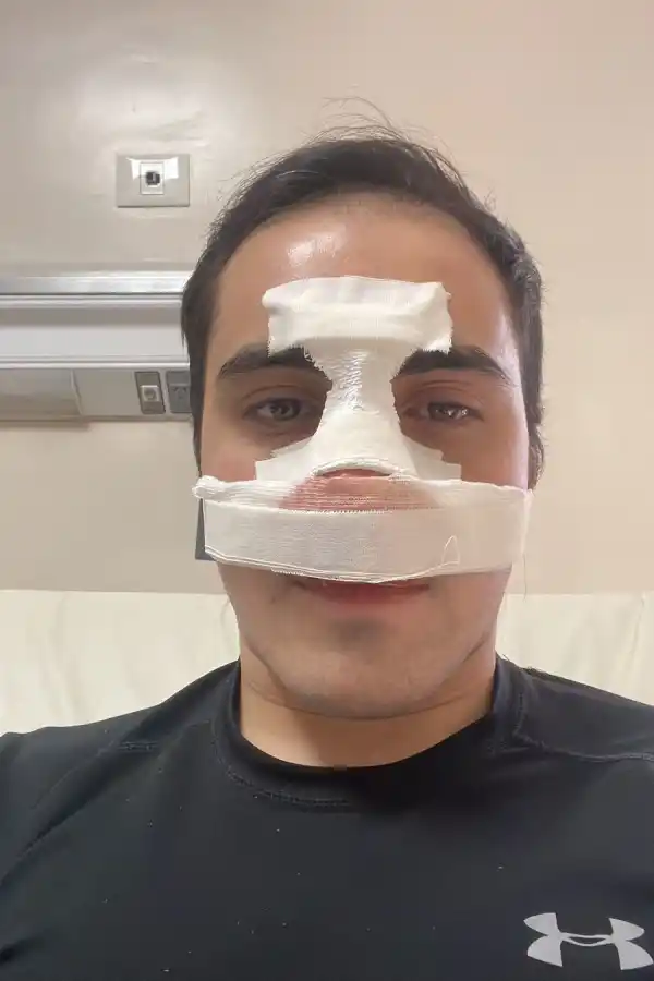 Navarro bancó un combate con el tabique nasal fracturado
