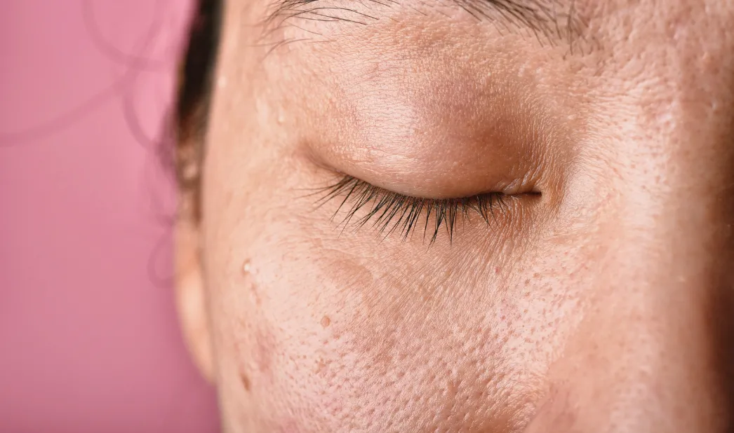 El protector de la piel disminuye su capacidad con el frío.