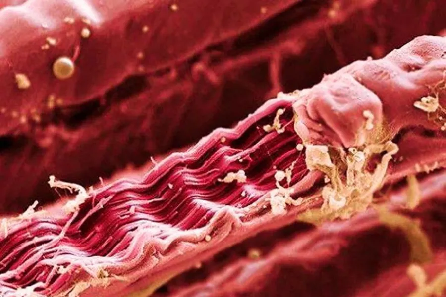 Las fibras musculares aumentan su tamaño si tenemos en cuenta ciertos factores.