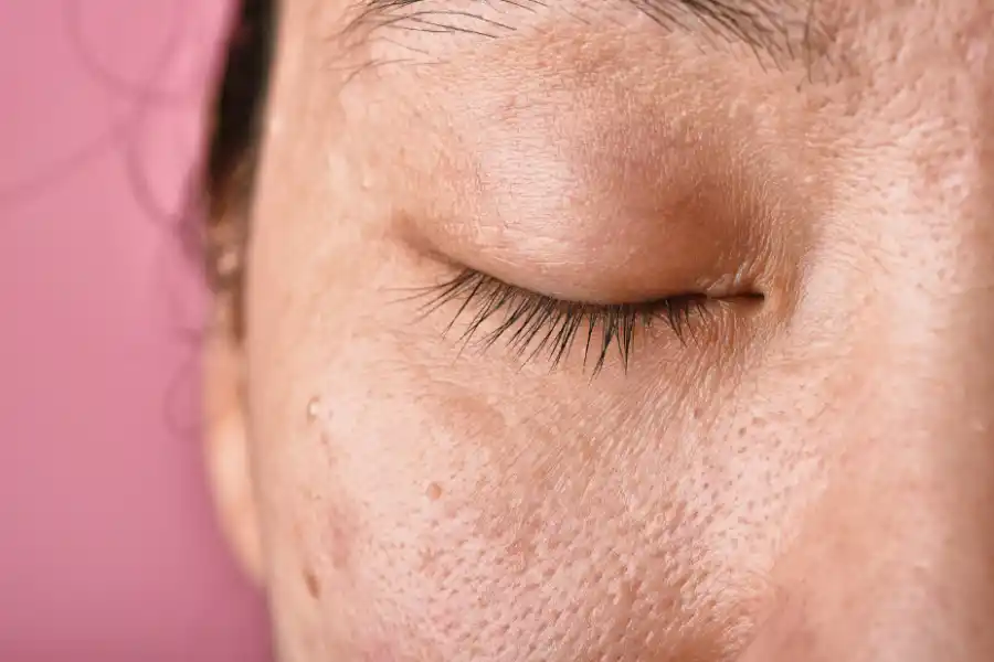 El protector de la piel disminuye su capacidad con el frío.