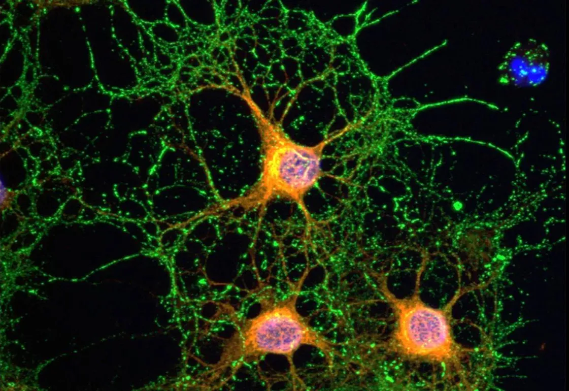 ¿Cómo se forman los recuerdos? la investigación que descubrió cómo funcionan las neuronas.