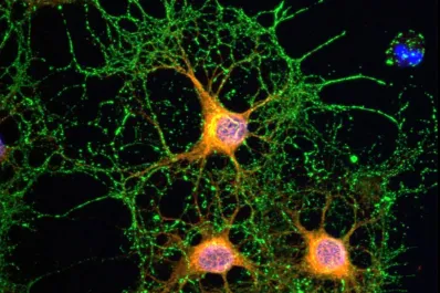 ¿Cómo funciona la memoria a corto plazo? la principal afectada en el mal de alzheimer