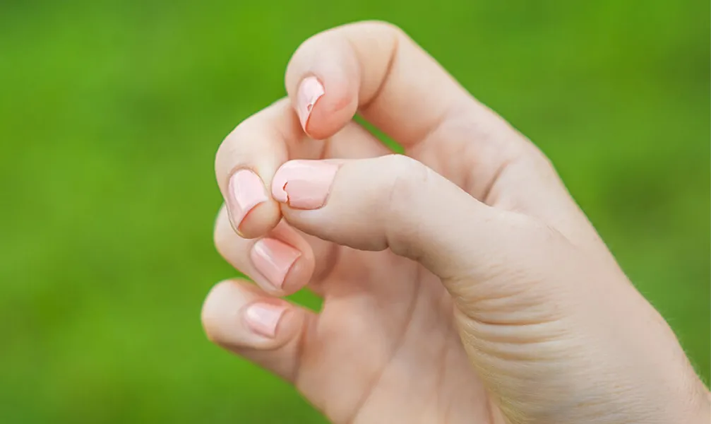 La proteína que necesita tu cuerpo para fortalecer las uñas quebradizas