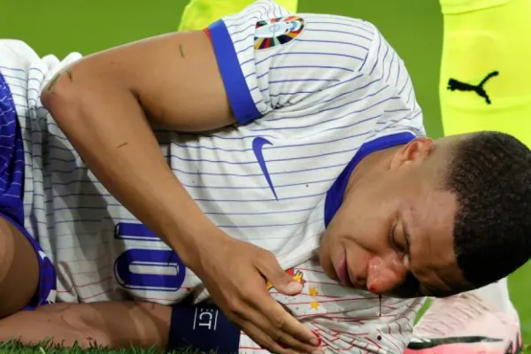 Kylian Mbappé se fracturó la nariz en el debut de Francia; ¿se queda afuera de la Eurocopa?