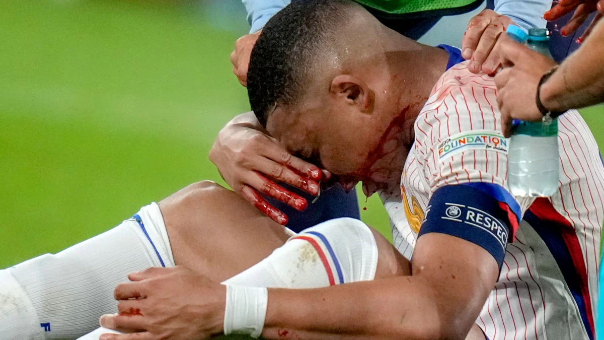 La primera foto de Kylian Mbappé con la Selección de Francia tras la fractura de nariz