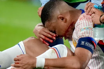 La primera foto de Kylian Mbappé con la Selección de Francia tras la fractura de nariz