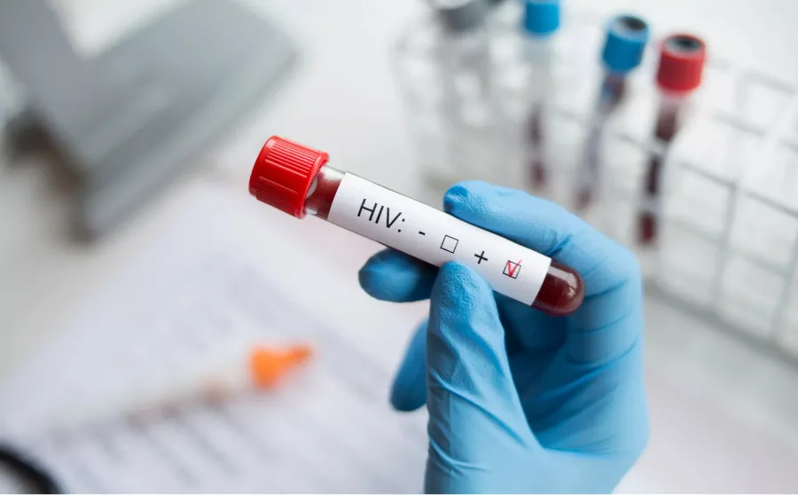 Los seis síntomas de VIH que aparecen 14 días después de contraer la enfermedad