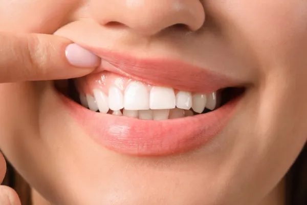 Alimentos con caseína, la proteína que repara el esmalte dental