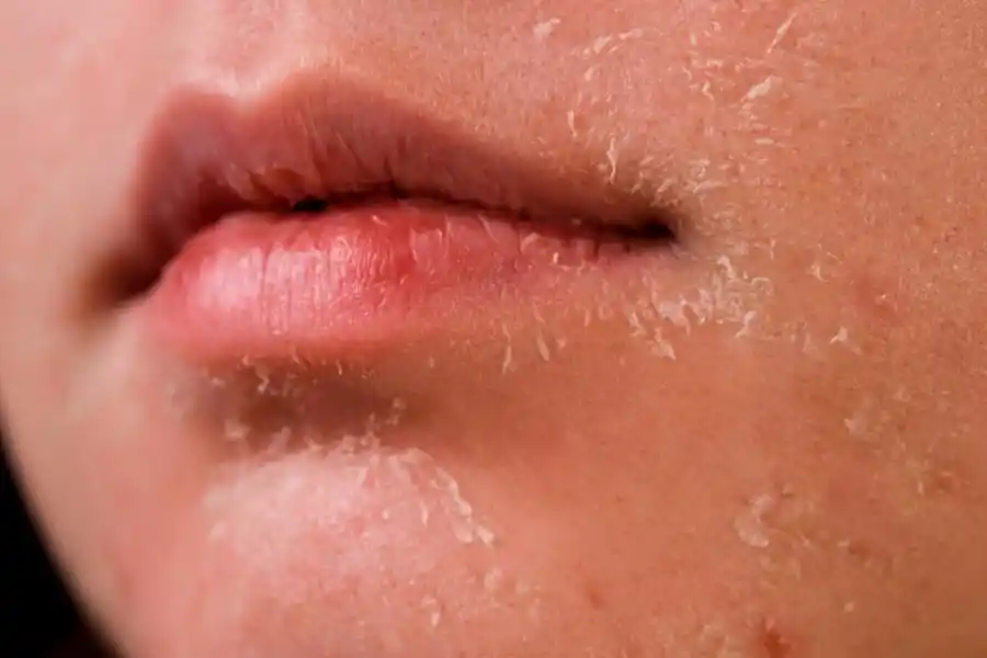 Bañarse todos los días puede provocar resecamiento de la piel.