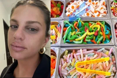 Una joven tucumana contó en TikTok que quedó internada tras comer una conocida golosina y generó muchos interrogantes