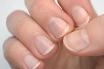 Si aparece esta marca en tus uñas deberías consultar al médico