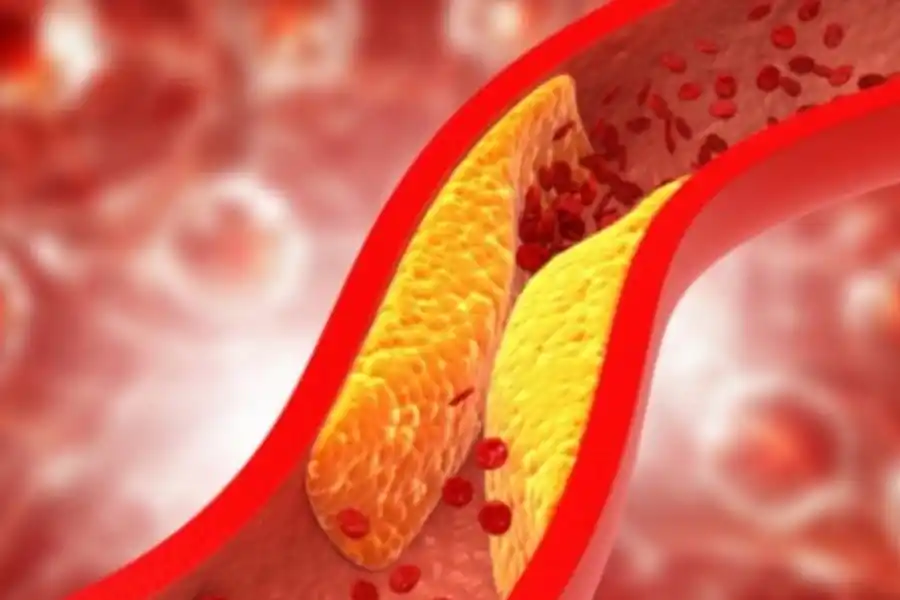 Las semillas de lino pueden reducir los triglicéridos en sangre.