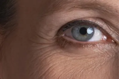 Esta es la proteína encargada de las arrugas: ¿se puede bloquear su funcionamiento?