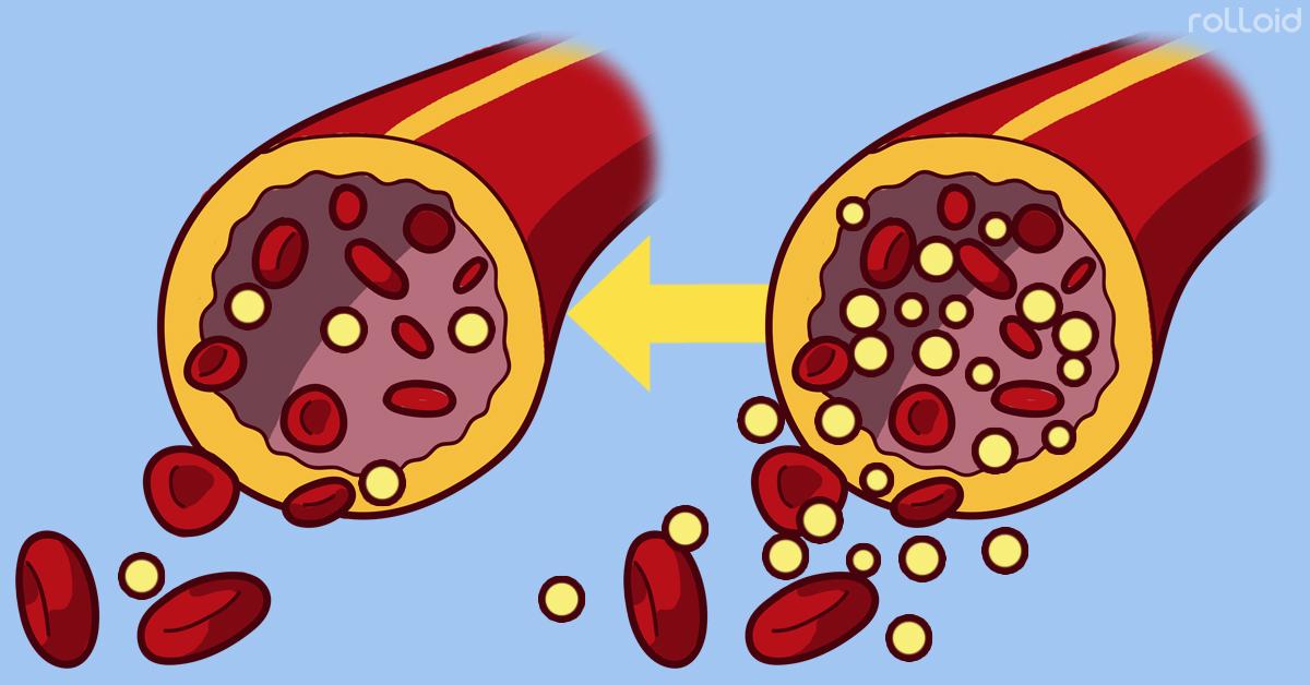 Los altos niveles de azúcar en sangre pueden promover enfermedades como la diabetes.