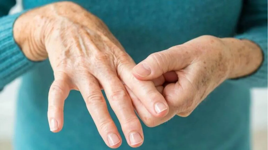 El tónico que puede aliviar los dolores de la artritis reumatoide
