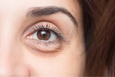 Cinco trucos para eliminar las bolsas debajo de los ojos