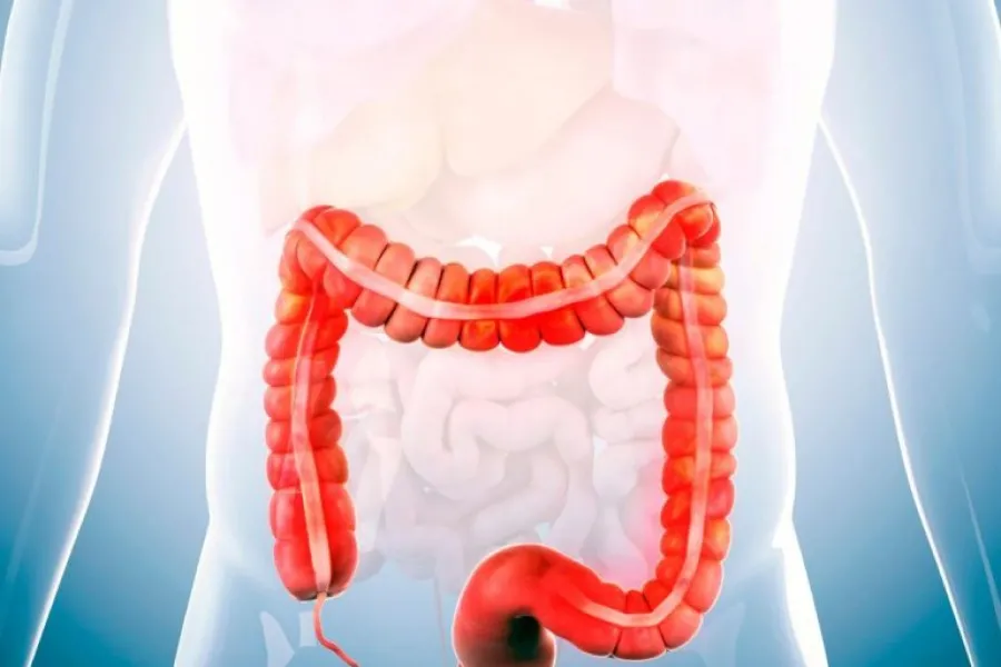 ¿Qué sucede cuando padecemos de colon irritable?