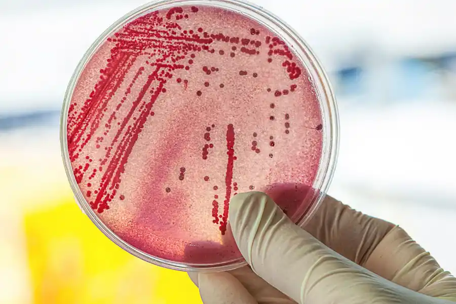 Escherichia Coli, una d elas nefermedades que pueden trasmitir las botellas.