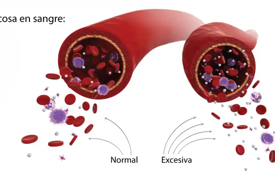 Los niveles altos de glucosa en sangre producen diabetes.