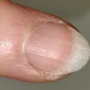 Las uñas pueden convertirse en un espejo de tu salud: ¿Qué significan las rayas que aparecen?