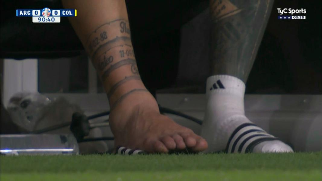 Una imagen para el recuerdo: así quedó el tobillo de Lionel Messi después de la lesión