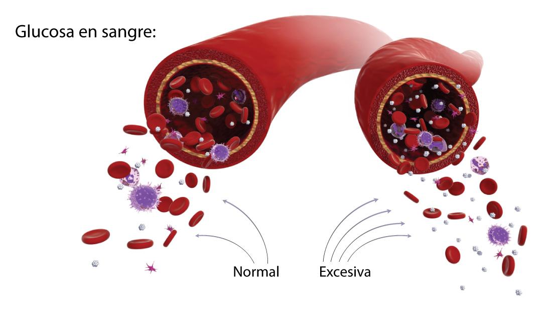 Los niveles altos de glucosa en sangre producen diabetes.