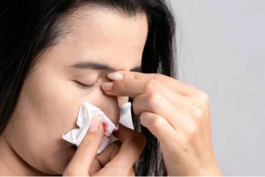 Algunas personas pueden presentar el sangrado nasal de manera recurrente, mientras que otras casi no lo presentan
