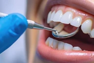 La mejor forma de prevenir el cáncer bucal