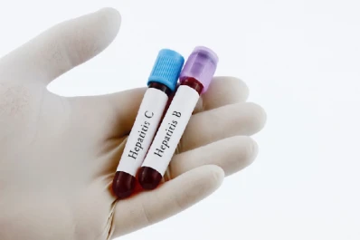 Campaña de testeos gratuitos para detectar hepatitis virales