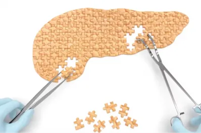 Cáncer de páncreas: los dos síntomas menos conocidos que podrían salvar tu vida