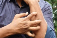 Micosis fungoide: cómo es el cáncer que se confunde con otras enfermedades de la piel