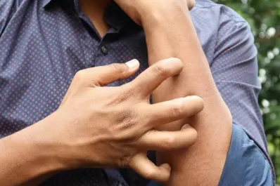 El cáncer de piel que no parece cáncer: claves para detectar la micosis fungoide