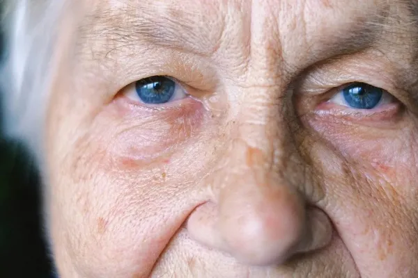 Estas señales en la visión pueden prevenir la demencia hasta 12 años antes, según la ciencia