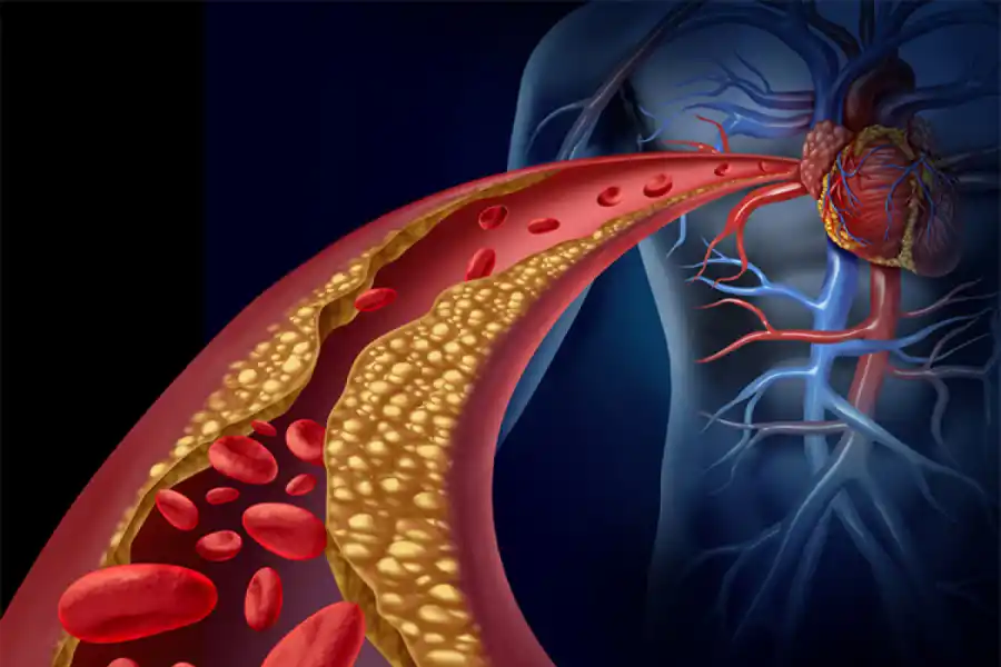 ¿Qué es el colesterol en sangre?