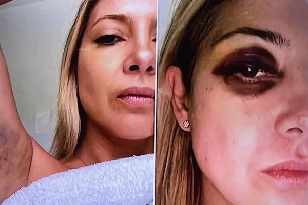 “Venís golpeándome hace tres días seguidos”: las fotos y los chats de la denuncia de Fabiola Yáñez a Alberto Fernández