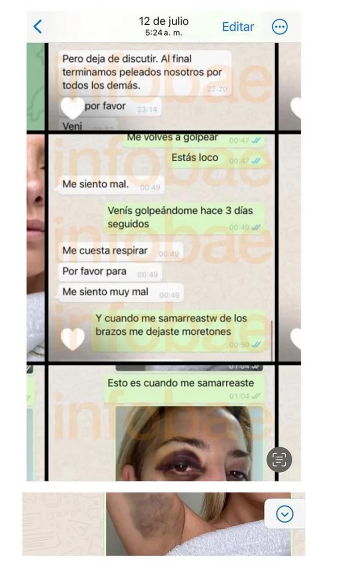 “Venís golpeándome hace tres días seguidos”: las fotos y los chats de la denuncia de Fabiola Yáñez a Alberto Fernández